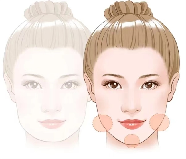 这三种特征不仅“显土气”还会“显脸胖”杏林改脸型(图2)