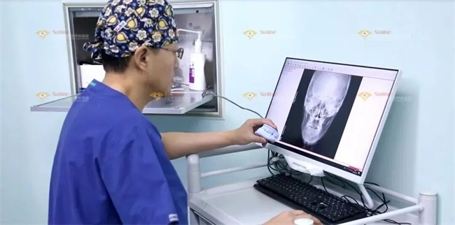 这三种特征不仅“显土气”还会“显脸胖”杏林改脸型(图13)