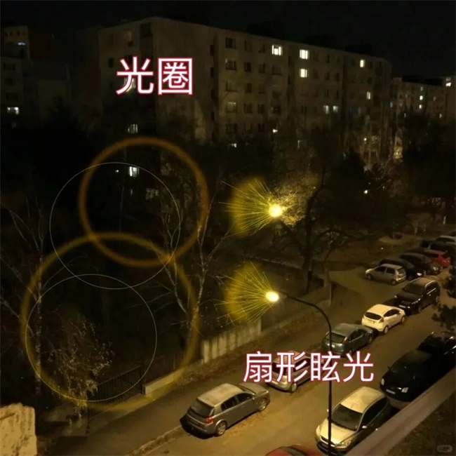 郑州近视手术术后眩光超全解答——尖峰眼科