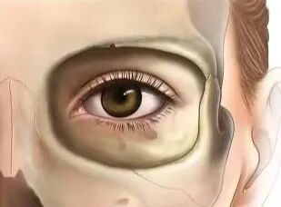 想做双眼皮，被「眼尾上扬」刷屏了？杏林眼综合(图4)