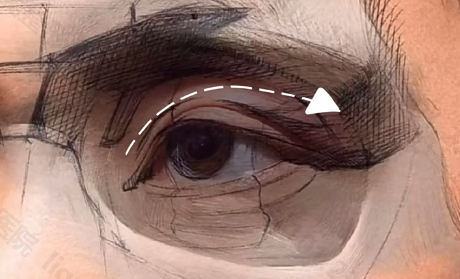 想做双眼皮，被「眼尾上扬」刷屏了？杏林眼综合(图5)